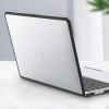 Захисний чохол EGYAL з TPU для MacBook Air M2 13.6 A2681 A3113, Black + Плівка + накладки на клавіатуру Захисний чохол EGYAL з TPU для MacBook Air M2 13.6 A2681 A3113, Black + Плівка + накладки на клавіатуру